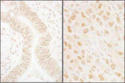 Immunohistochemistry: OBFC2B Antibody [NBP1-06561]