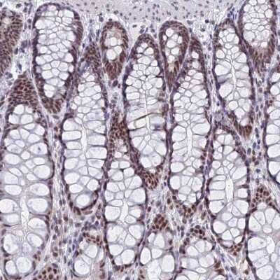 Immunohistochemistry-Paraffin: OBFC2B Antibody [NBP1-82718]