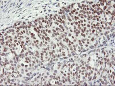 Immunohistochemistry: OBFC2B Antibody (OTI1E11) - Azide and BSA Free [NBP2-73140]