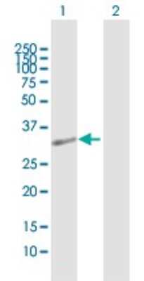 Western Blot: OBFC2B Antibody [H00079035-B01P]