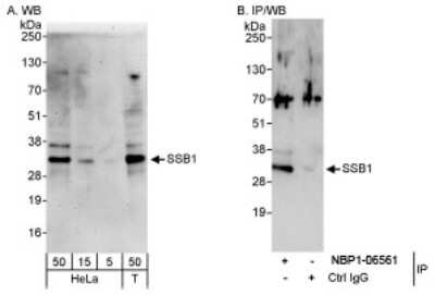 Western Blot: OBFC2B Antibody [NBP1-06561]