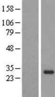 Western Blot: OBFC2B Overexpression Lysate [NBL1-13900]