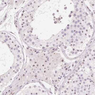 Immunohistochemistry: OBP2A Antibody [NBP2-47349]