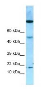 Western Blot: OBP2A Antibody [NBP1-98584]