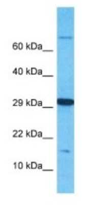 Western Blot: OBP2B Antibody [NBP3-09756]