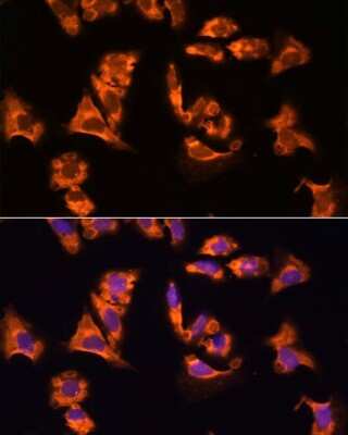 Immunocytochemistry/ Immunofluorescence: OBSCN Antibody - Azide and BSA Free [NBP3-05247]