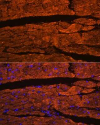 Immunohistochemistry: OBSCN Antibody - Azide and BSA Free [NBP3-05247]