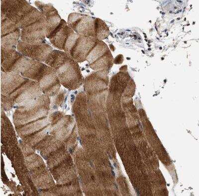 Immunohistochemistry-Paraffin: OBSCN Antibody [NBP1-88818]