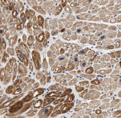 Immunohistochemistry-Paraffin: OBSCN Antibody [NBP1-88818]
