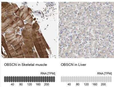 Immunohistochemistry-Paraffin: OBSCN Antibody [NBP1-88818]