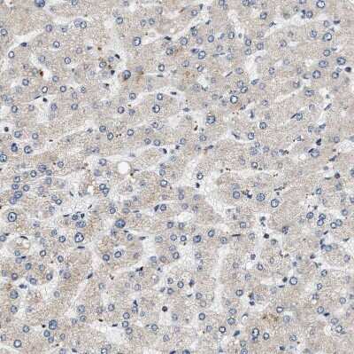 Immunohistochemistry-Paraffin: OBSCN Antibody [NBP1-88818]