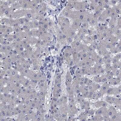 Immunohistochemistry-Paraffin: OBSCN Antibody [NBP3-17108]