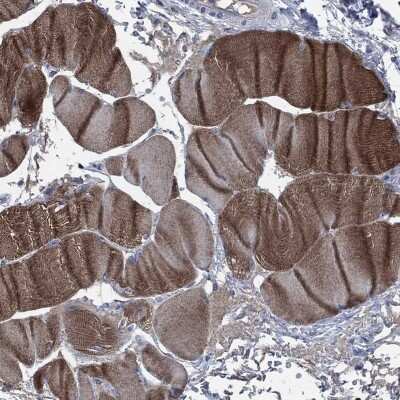 Immunohistochemistry-Paraffin: OBSCN Antibody [NBP3-17108]