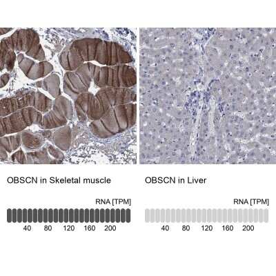 Immunohistochemistry-Paraffin: OBSCN Antibody [NBP3-17108]