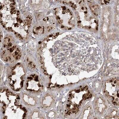 Immunohistochemistry-Paraffin: OBSL1 Antibody [NBP1-93625]