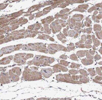 Immunohistochemistry-Paraffin: OBSL1 Antibody [NBP2-38299]