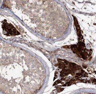 Immunohistochemistry-Paraffin: OBSL1 Antibody [NBP2-38299]