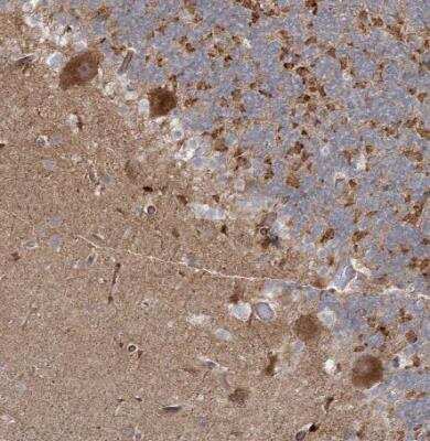 Immunohistochemistry-Paraffin: OBSL1 Antibody [NBP2-38299]