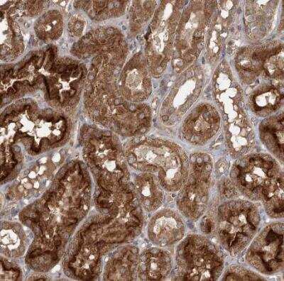 Immunohistochemistry-Paraffin: OBSL1 Antibody [NBP2-38299]