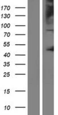 Western Blot: OCA2 Overexpression Lysate [NBP2-09041]