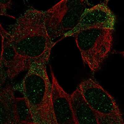 Immunocytochemistry/ Immunofluorescence: OCAM/NCAM2 Antibody [NBP2-55559]