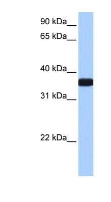 Western Blot: OCEL1 Antibody [NBP1-79396]