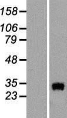 Western Blot: OCEL1 Overexpression Lysate [NBL1-13902]