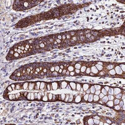 Immunohistochemistry-Paraffin: OCIAD1 Antibody [NBP1-92218]