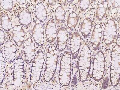 Immunohistochemistry-Paraffin: OCIAD1 Antibody [NBP2-97855]