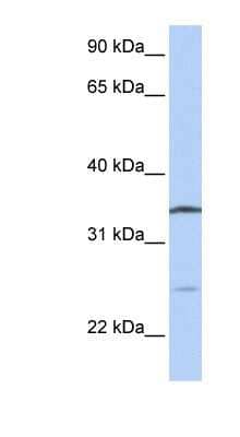 Western Blot: OCIAD1 Antibody [NBP1-54905]