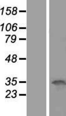 Western Blot: OCIAD1 Overexpression Lysate [NBP2-08477]