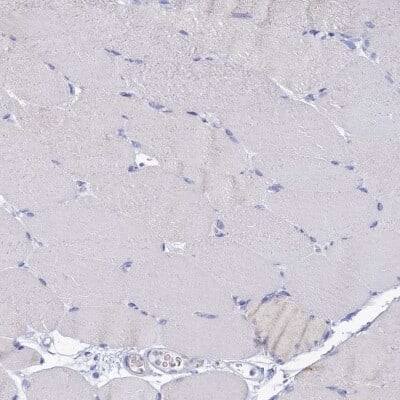 Immunohistochemistry-Paraffin: OCIAD2 Antibody [NBP1-82682]
