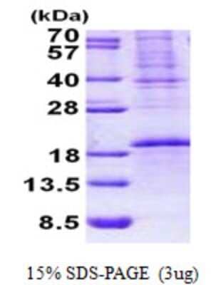 SDS-PAGE: Recombinant Human OCIAD2 His Protein [NBP2-23305]