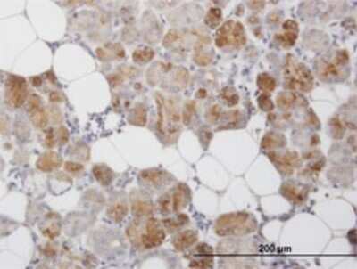 Immunohistochemistry-Paraffin: OCIL/CLEC2d Antibody (4C7) [H00029121-M01]