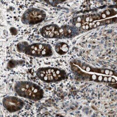 Immunohistochemistry-Paraffin: OCIL/CLEC2d Antibody [NBP1-84455]