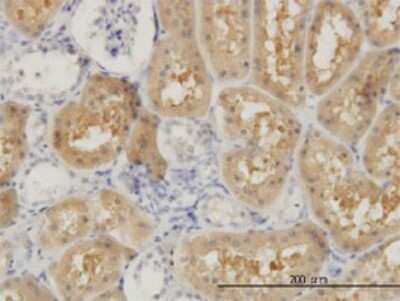 Immunohistochemistry-Paraffin: OCRL Antibody (4A6) [H00004952-M02]