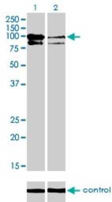 Western Blot: OCRL Antibody (4A6) [H00004952-M02]