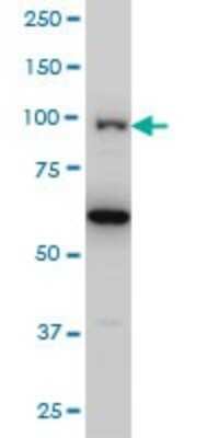 Western Blot: OCRL Antibody (4A6) [H00004952-M02]