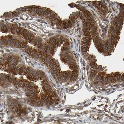 Immunohistochemistry-Paraffin: OCRL Antibody [NBP1-80973]