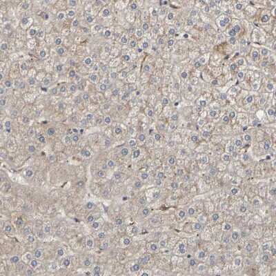 Immunohistochemistry-Paraffin: OCRL Antibody [NBP1-80973]