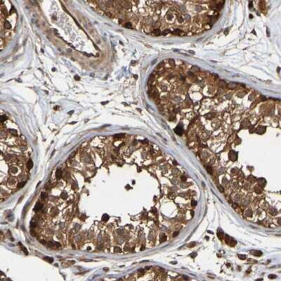 Immunohistochemistry-Paraffin: OCRL Antibody [NBP1-80973]