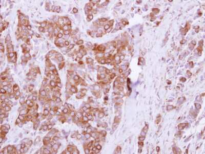 Immunohistochemistry-Paraffin: OCRL Antibody [NBP2-19621]