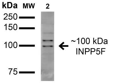 Western Blot: OCRL Antibody (S166A-26) [NBP2-42193]