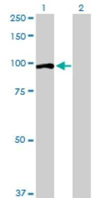 Western Blot: OCRL Antibody [H00004952-D01P]