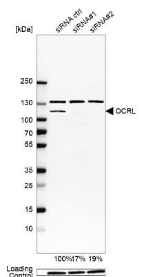 Western Blot: OCRL Antibody [NBP1-80973]