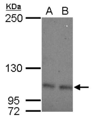 Western Blot: OCRL Antibody [NBP2-19621]