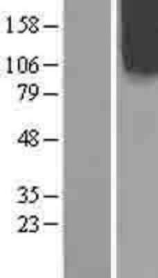 Western Blot: OCRL Overexpression Lysate [NBL1-13905]