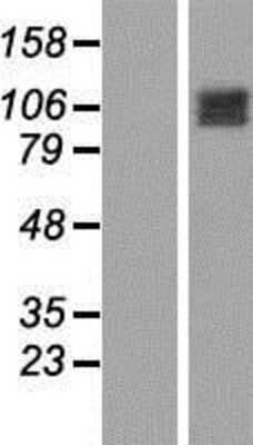 Western Blot: OCRL Overexpression Lysate [NBP2-09774]