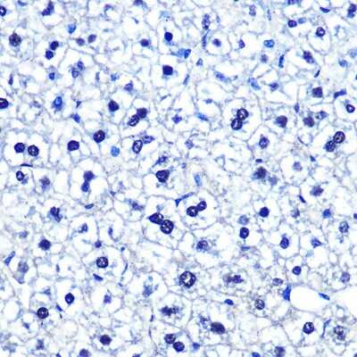 Immunohistochemistry-Paraffin: OCT1 Antibody (8L4Y5) [NBP3-16246]