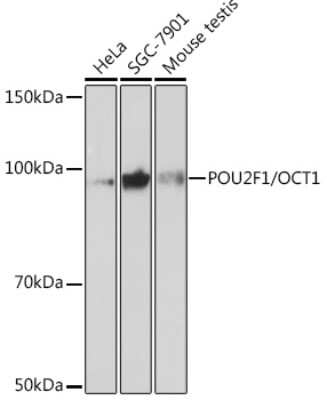 Western Blot: OCT1 Antibody (8L4Y5) [NBP3-16246]